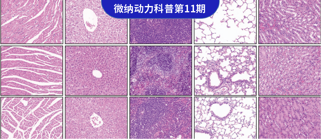 TechInsights #11 《Small》：Dual Responsive Magnetic DCR3 Nanoparticles: A New Strategy for Efficiently Targeting Hepatocellular Carcinoma
